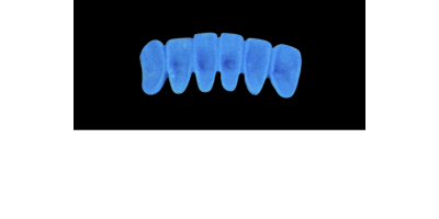 Cod.A14Lingual : 10x  wax lingual bridges,  Medium, Overlapping, TOOTH 43-33, compatible with Cod.C14Facing,TOOTH  43-33 for long-term provisionals preparation
